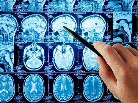 Ученые возлагают большие надежды в разгадке секретов мозга на магнитно-резонансный томограф. Фото: PhotoXpress